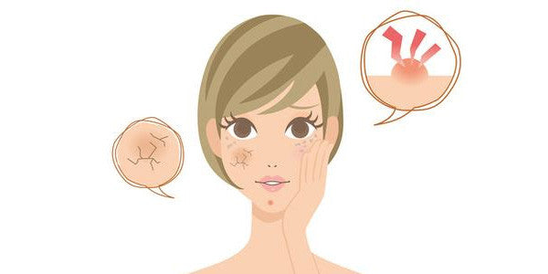 Sorte prikker og hudormer